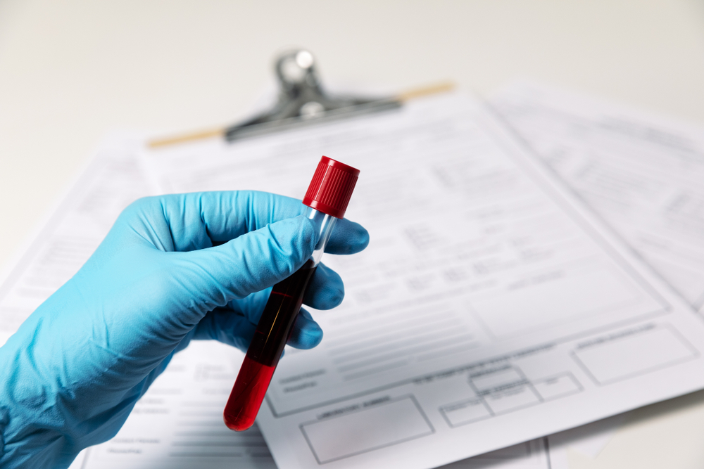 Gloved hand holding a blood sample in a red-capped test tube over medical forms/clipboard
